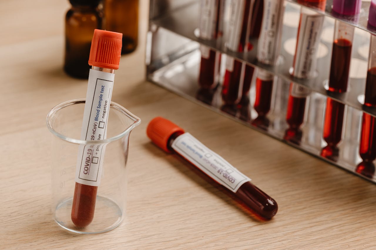 Serological tests involving viruses, bacteria, or fungi.