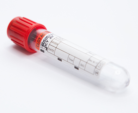 Serological tests involving viruses, bacteria, or fungi.